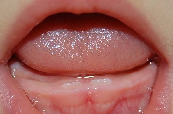 Зубки пипец. (фото)прорезывание зубов у детей, у грудничков