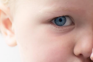 Красный глаз у грудничка, ребенка 6 месяцев, годовалого: причины у грудных детей, что делать, если белок покраснел, слезится