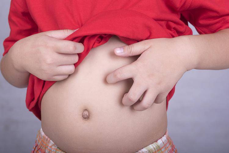 Гормональная сыпь у новорожденных и грудничков
