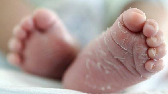 Почему облазит кожа у новорожденного на ручках, ножках, животе, лице