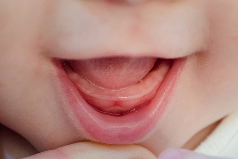 Схема выпадения молочных зубов у детей