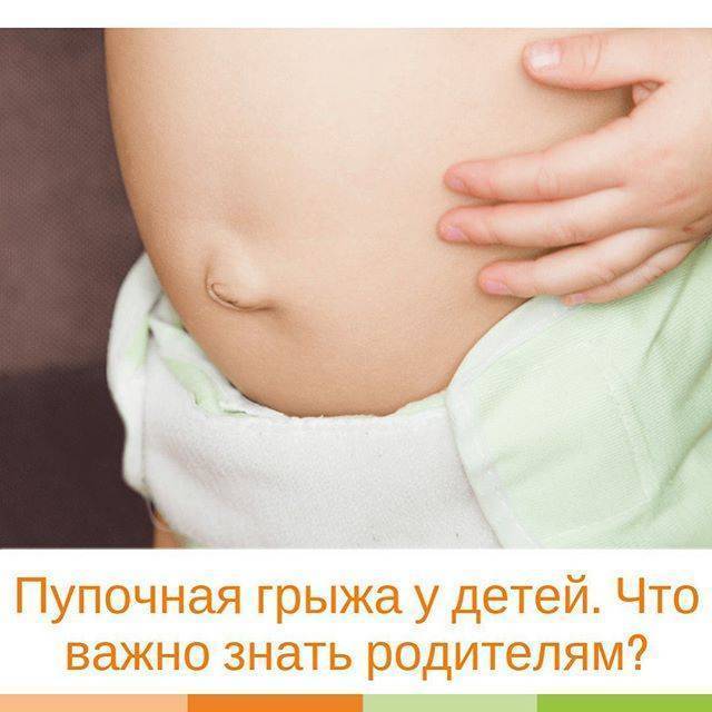 Пупочная грыжа у новорожденных (53 фото): как выглядит, симптомы и лечение у грудничков-мальчиков, массаж