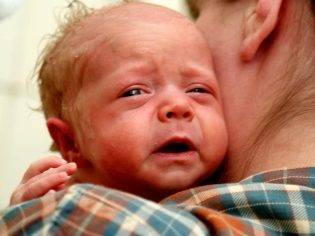 Гноятся глаза у новорожденного — что нужно предпринять