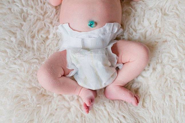 Сколько по времени заживает пупок у новорожденного и как пережить это время без осложнений