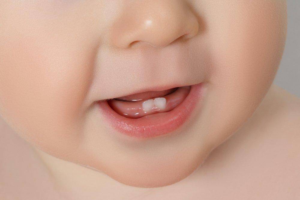 Как выглядят на фото набухшие десны при прорезывании первых зубов у грудничков