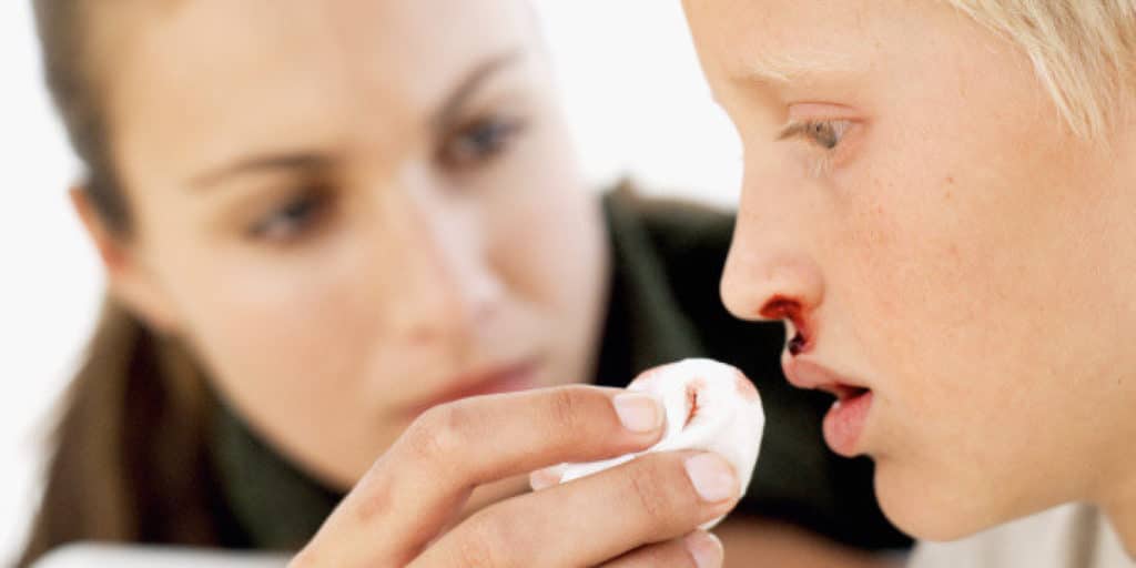 Перелом носа у ребенка: симптомы и признаки с фото, способы определения травмы