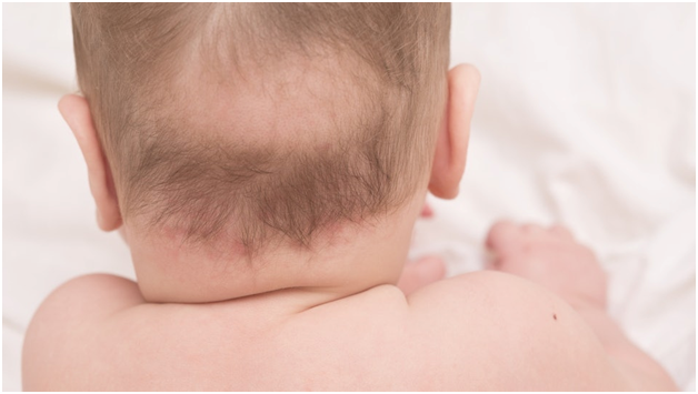 Волосы у новорожденных