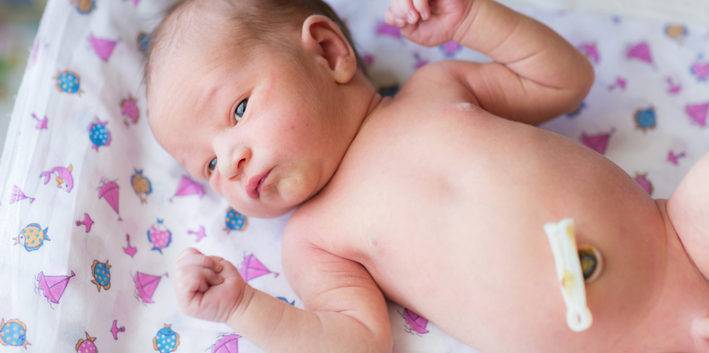 Обработка пуповины новорожденного: правила и алгоритм действий