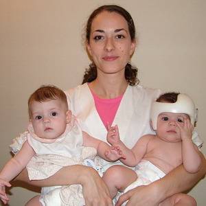 Deformaciya-cherepa - запись пользователя екатерина (artimka) в сообществе здоровье новорожденных в категории кривошея - babyblog.ru