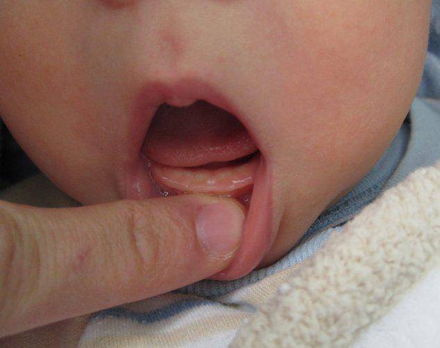 Когда начинают расти и во сколько режутся зубы у новорождённого