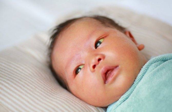 Желтоватые склеры глаз!!!! 3 недели! - запись пользователя ленка (id2442877) в сообществе здоровье новорожденных в категории желтуха новорожденных - babyblog.ru