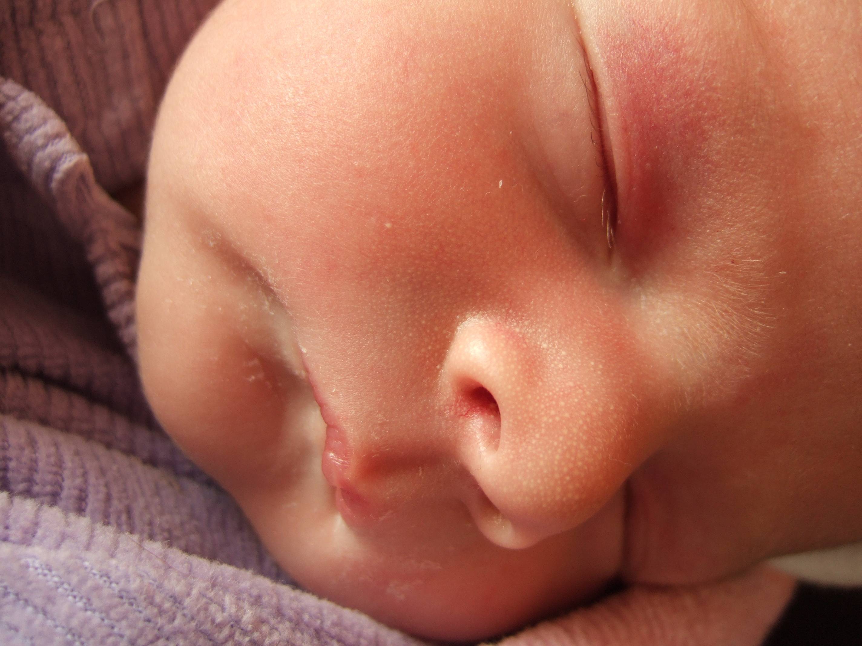 Тремор у новорожденных: причины и лечение
