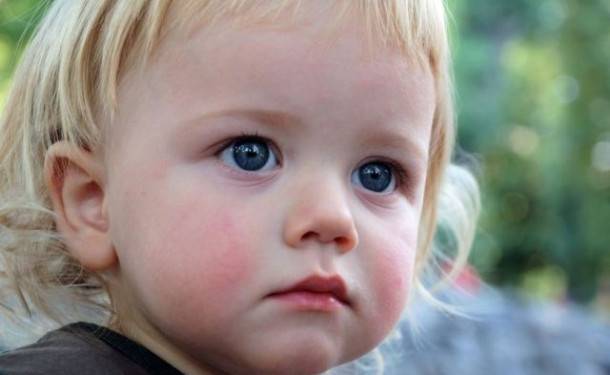 Сыпь на языке у ребенка (24 фото): высыпания во рту и на небе, причины красной сыпи