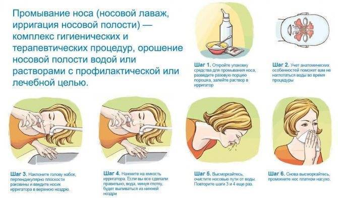 Е. комаровский: рецепт солевого раствора для промывания носа ребенку - как сделать, как промывать нос новорожденному соляным физраствором в домашних условиях