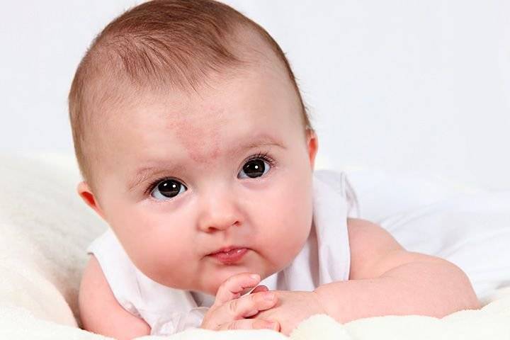 Красные пятна на лице у ребенка, новорожденного. фото, причины возникновения, чем лечить