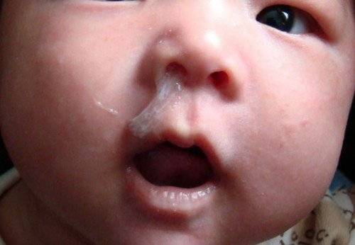 Чем чистим носик? - грудничок не дает чистить нос - запись пользователя ирина вавинова (vavinova) в сообществе здоровье новорожденных в категории аптечка - babyblog.ru