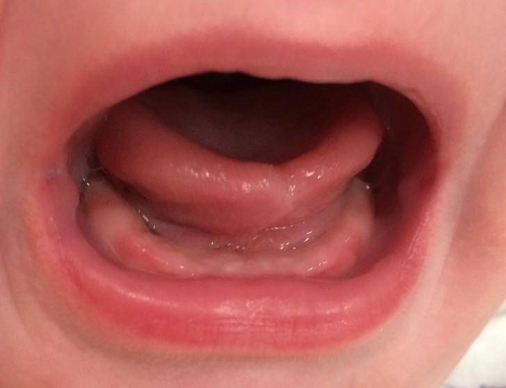 Какие зубы первыми лезут у ребенка?