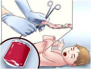 Что делать если кровит пупок у новорожденных: причины и действия