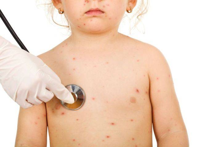 Детские болезни с высыпаниями на коже и лице, с и без температуры. фото, признаки