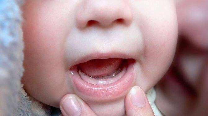 Прорезывание зубов у детей до года и старше