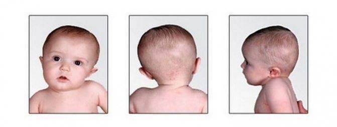 Ребенку 2 месяца, а мы запрокидываем назад голову... - двухмесячный ребенок запрокидывает голову назад - запись пользователя валентинка (teana) в сообществе здоровье новорожденных в категории неврология - babyblog.ru