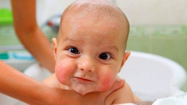 Е. комаровский: сухая кожа у ребенка - причины у младенца,сухость кожи щек и ног у малыша
