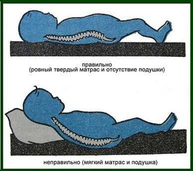 Можно ли спать на мягком? - можно ли новорожденному спать на мягком - запись пользователя ♛анна♛ (seledo4ka) в сообществе здоровье новорожденных в категории ортопедия - babyblog.ru