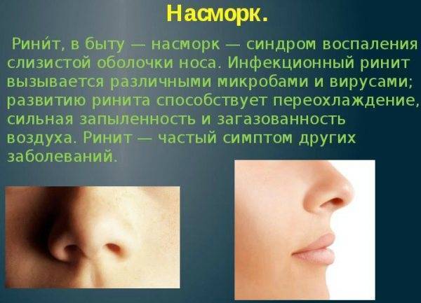 Что-то малыш мой хрюкает.. - заложен нос у грудничка хрюкает - запись пользователя елена (paradiso) в сообществе здоровье новорожденных в категории насморк и прочие заболевания носа - babyblog.ru