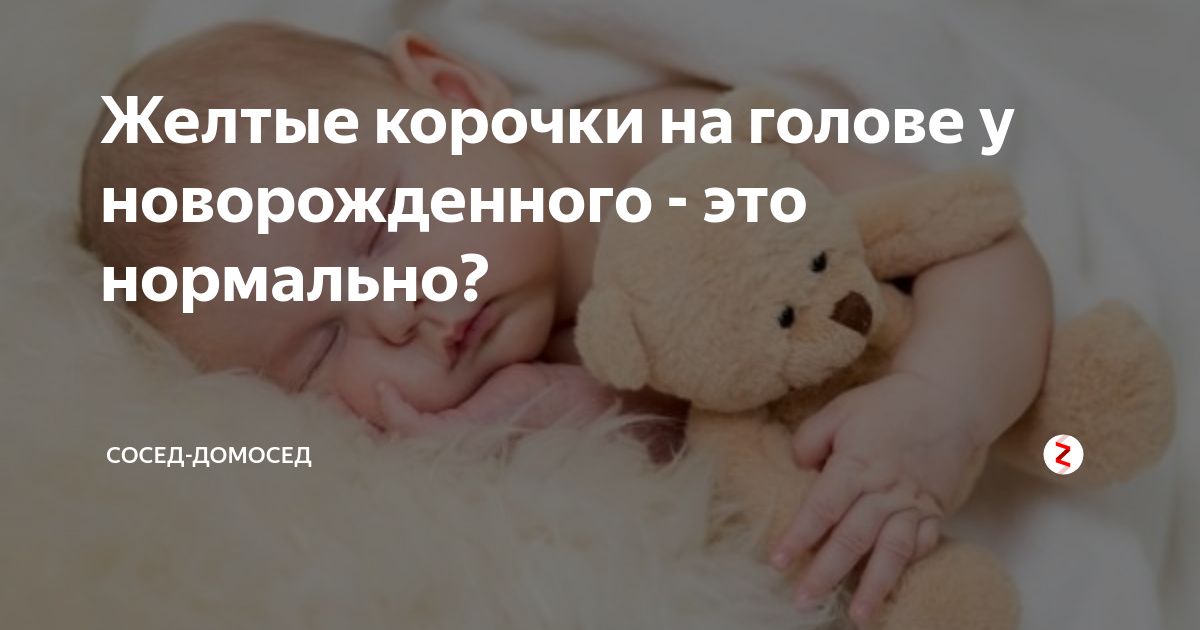 Расскажите, как подробно вычесывать корочки на голове у малыша?? - как вычесать корочку на голове у ребенка - запись пользователя в мире ощущений (nastyaa) в дневнике - babyblog.ru