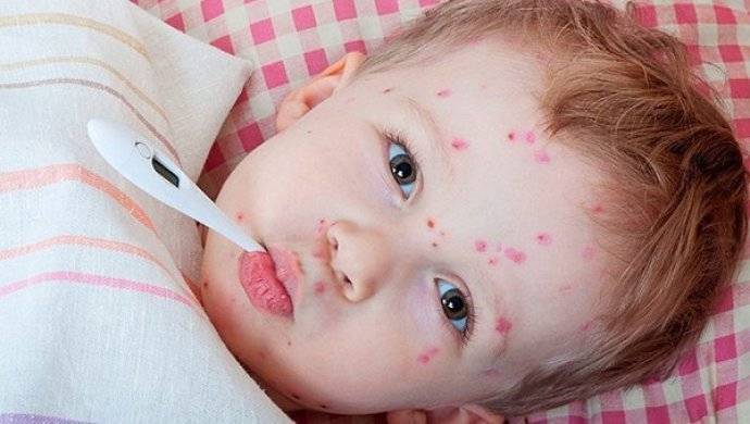 Как выглядит аллергическая сыпь у детей?