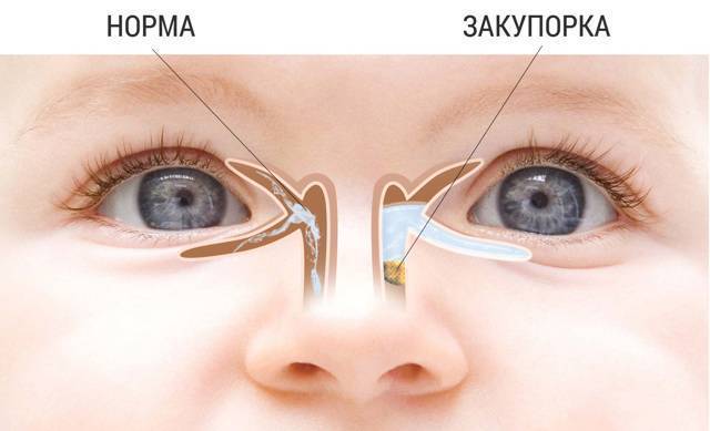 Пленка на глазах: причины, лечение и профилактика