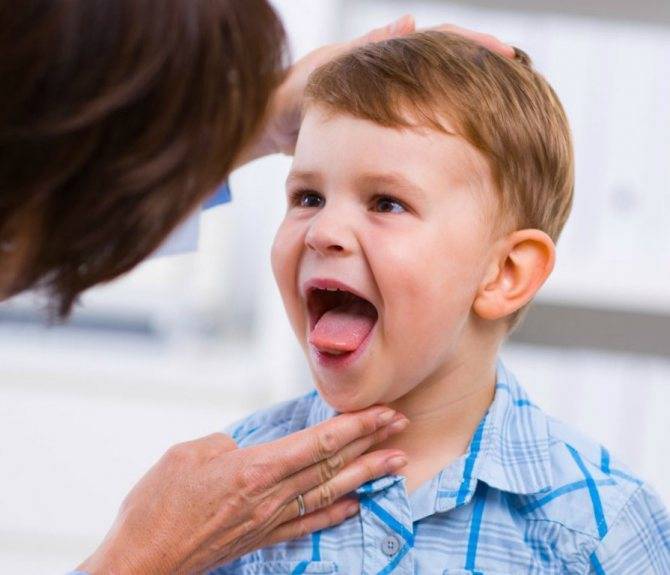 У ребенка болит горло и температура выше 38: в горле гнойники и пузырьки, высокая температура - 39