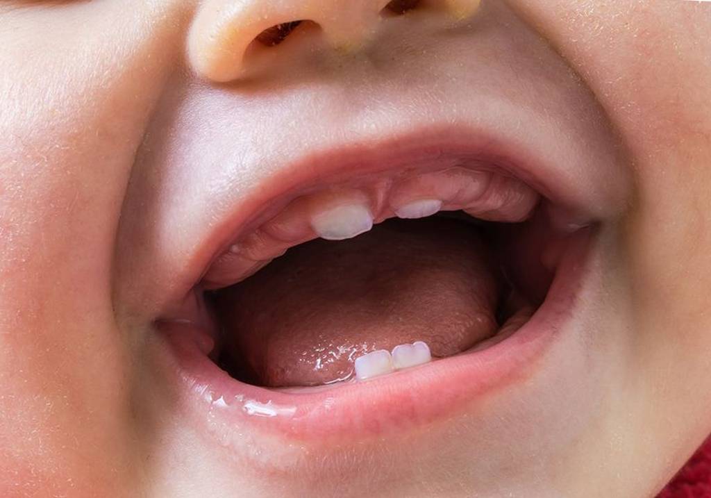 Как проходит прорезывание зубов у детей