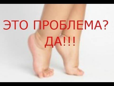 Ребенок резко начал ходить на носочках - запись пользователя lady in black (id1491989) в сообществе детские болезни от года до трех в категории ортопедия - babyblog.ru