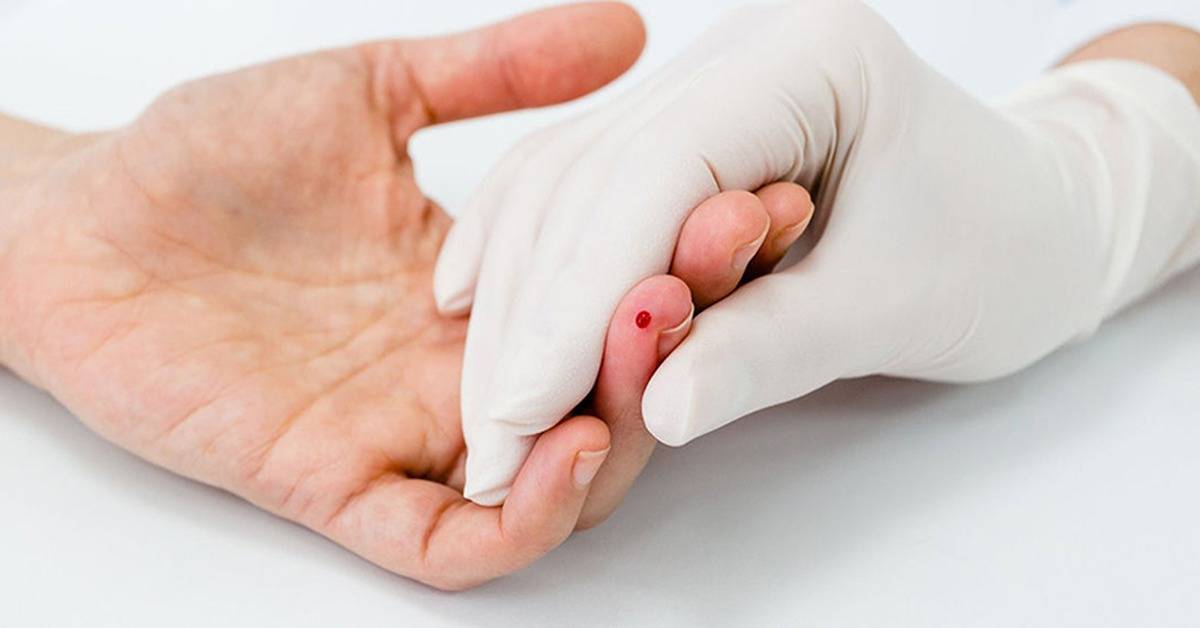 Как берут кровь из пальца у грудничков, подготовка ребенка к анализу