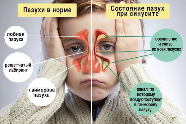 Kak-pochistit-malyshu-nosik - запись пользователя нагима (kukusina) в сообществе здоровье новорожденных в категории насморк и прочие заболевания носа - babyblog.ru