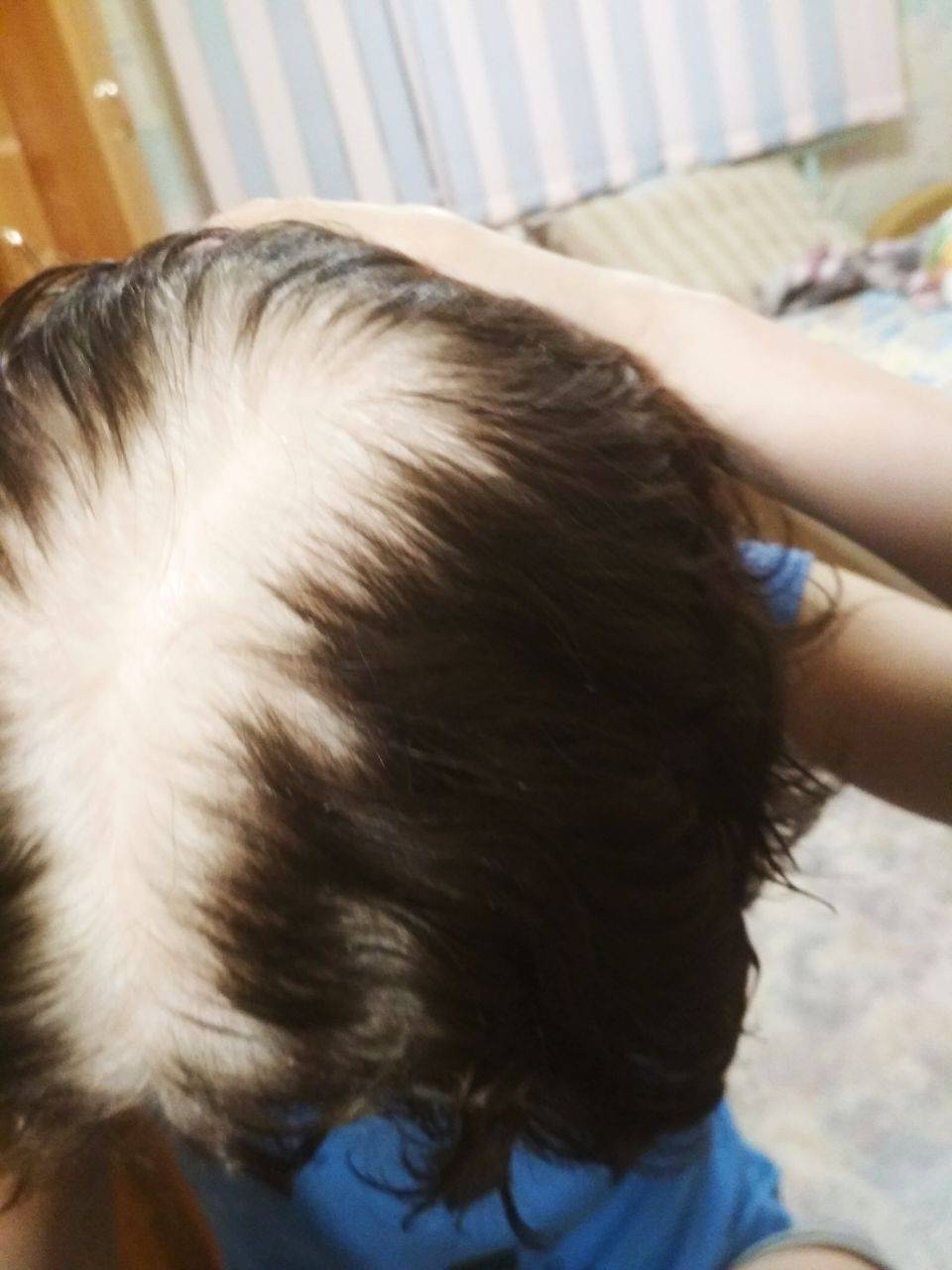 У ребенка плохо растут волосы на голове - что делать и в чем причины
