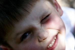 Нервный тик глаза у ребенка: причины появления и методы лечения