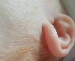 Шелушится кожа у новорожденного (35 фото): почему есть шелушение на теле, что делать – причины у грудничка