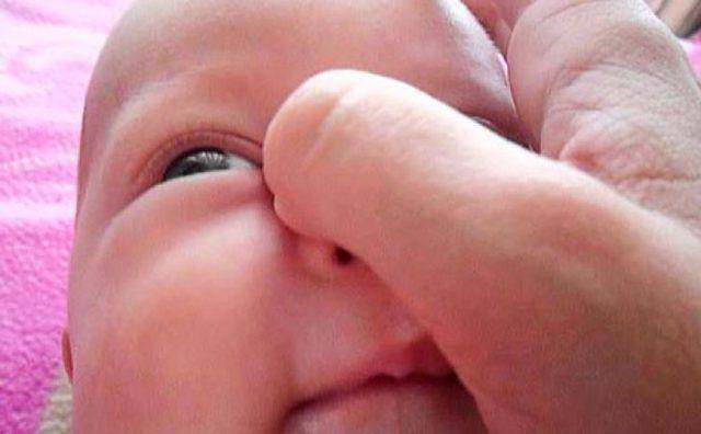 Зондирование слезного канала глаз: операция новорожденным