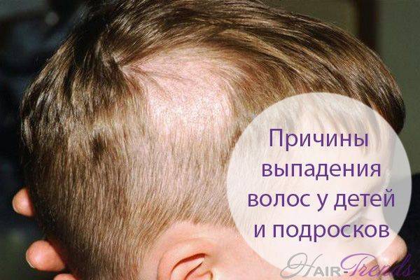Выпали волосы... - запись пользователя нютик (id1336743) в сообществе здоровье новорожденных в категории разное - babyblog.ru