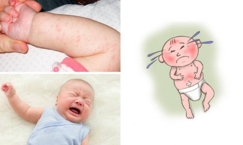 Аллергия на гречку у грудничка до года