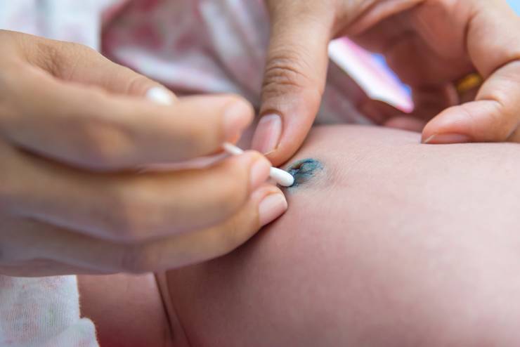 Обработка пупка новорождённого: используемые средства и правила проведения процедуры