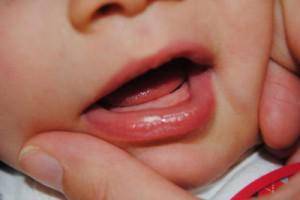 Как понять что у ребенка режутся зубы в 4 месяца