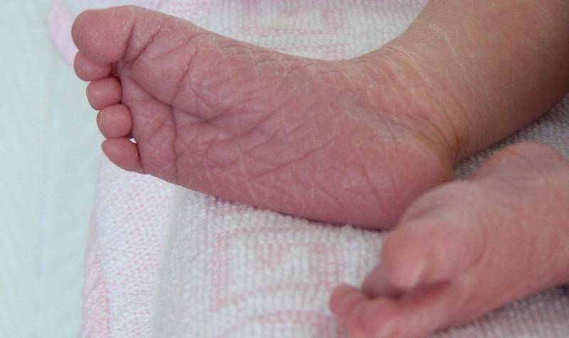Красные прыщики возле глаз и облазит кожа у новорожденного... - у новорожденного облазит кожа - запись пользователя кэти (masyanya1) в сообществе здоровье новорожденных в категории болезни глаз - babyblog.ru