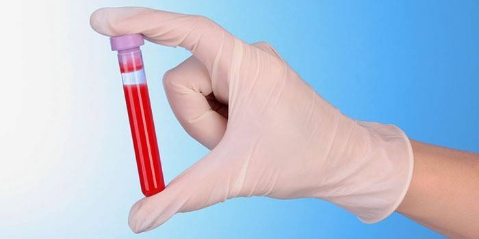 Повышенные лейкоциты в крови у ребенка: причины патологии, что делать родителям