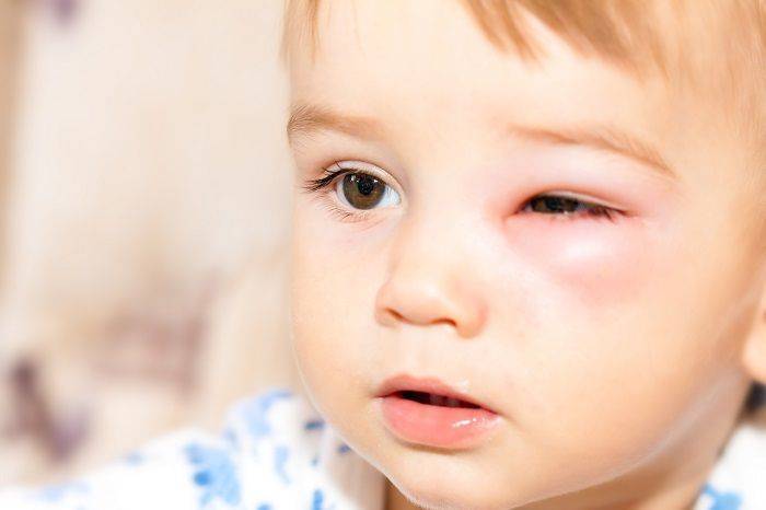 Почему ребенок пучит глазки