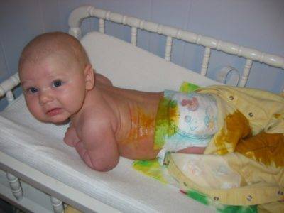 Krasnaya-kakashka - запись пользователя мама тёмы (id1030571) в сообществе здоровье новорожденных в категории стул новорожденного - babyblog.ru