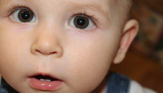 Желтые глаза. причины желтизны белков глаз, диагностика причин, лечение патологий :: polismed.com