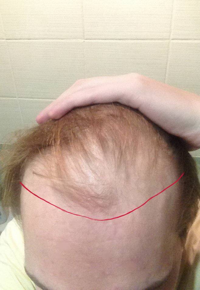 Когда брить голову младенцу? - как брить голову новорожденному - запись пользователя людвия (id1076385) в сообществе ислам в категории 5.5. рождение - babyblog.ru